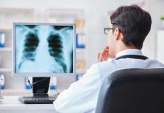 Pulmonary Fibrosis