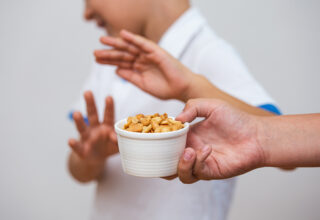Food Allergies